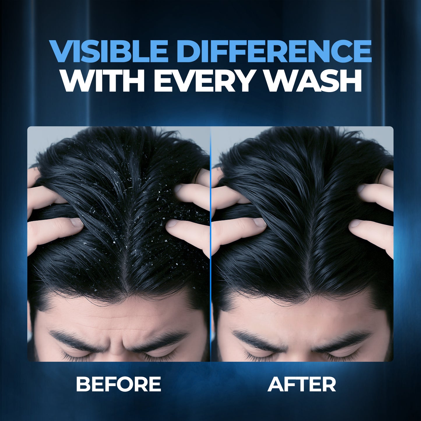 Beardo Dandruff Control Sulphate Free Shampoo