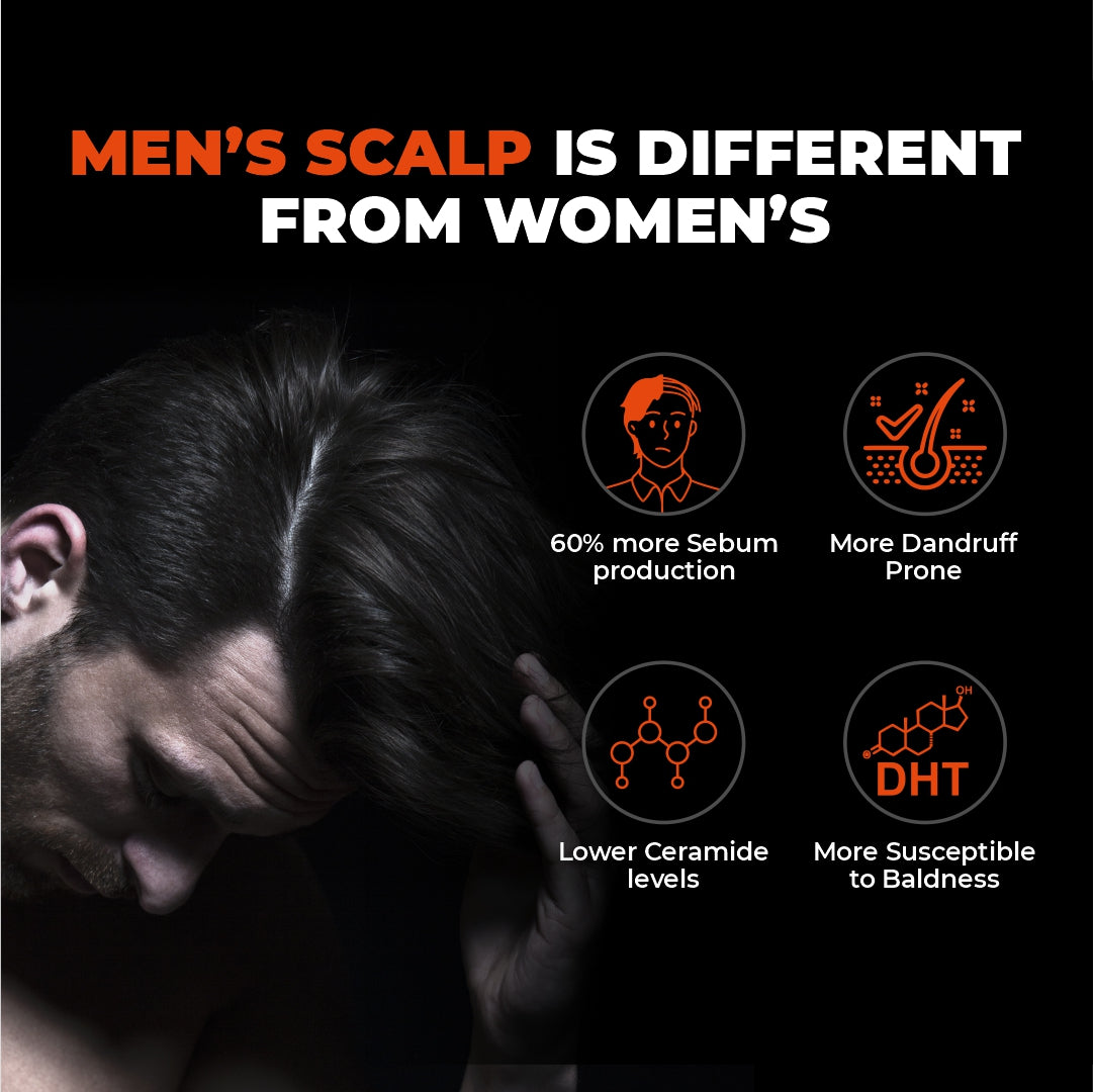 men scalp, men's scalp, hair fall reason in men