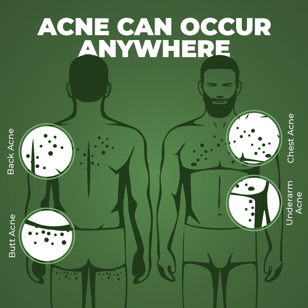 Beardo Monsoon Essentials Combo