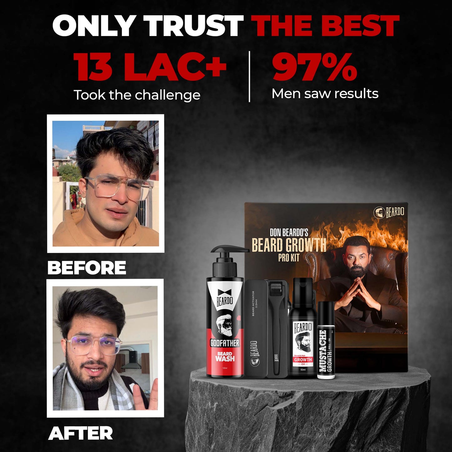 Beard growth kit with 'Before' and 'After' images on a dark background