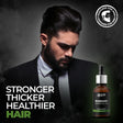 rosemary oil for hair loss, rosemary oil benefits for hair, best rosemary oil for hair, best rosemary oil