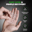 Beardo Doctor Acne Pimple Patch – formula and texture close-up