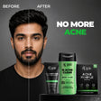 Acne Ka The End