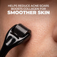 Derma Roller Hygiene Combo
