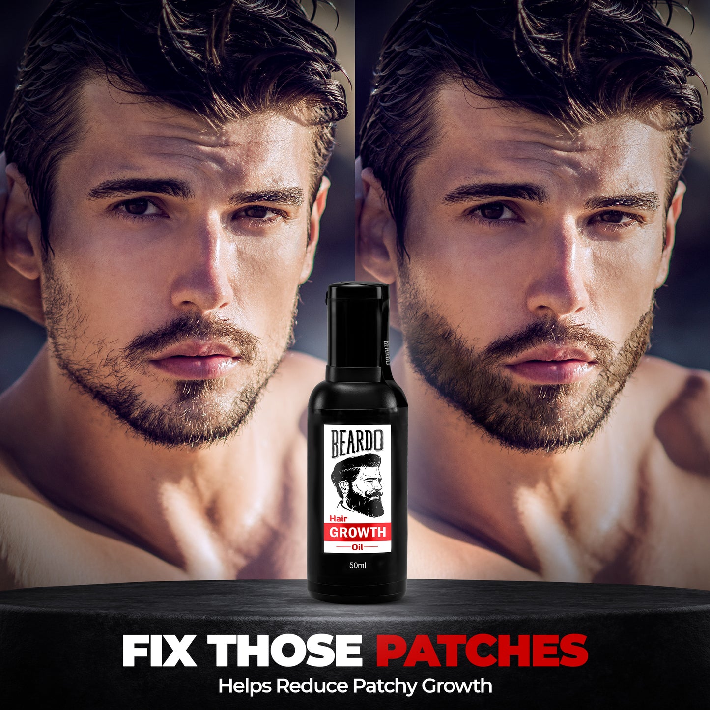 patchy growth, patchy beard solution, patchy beard
