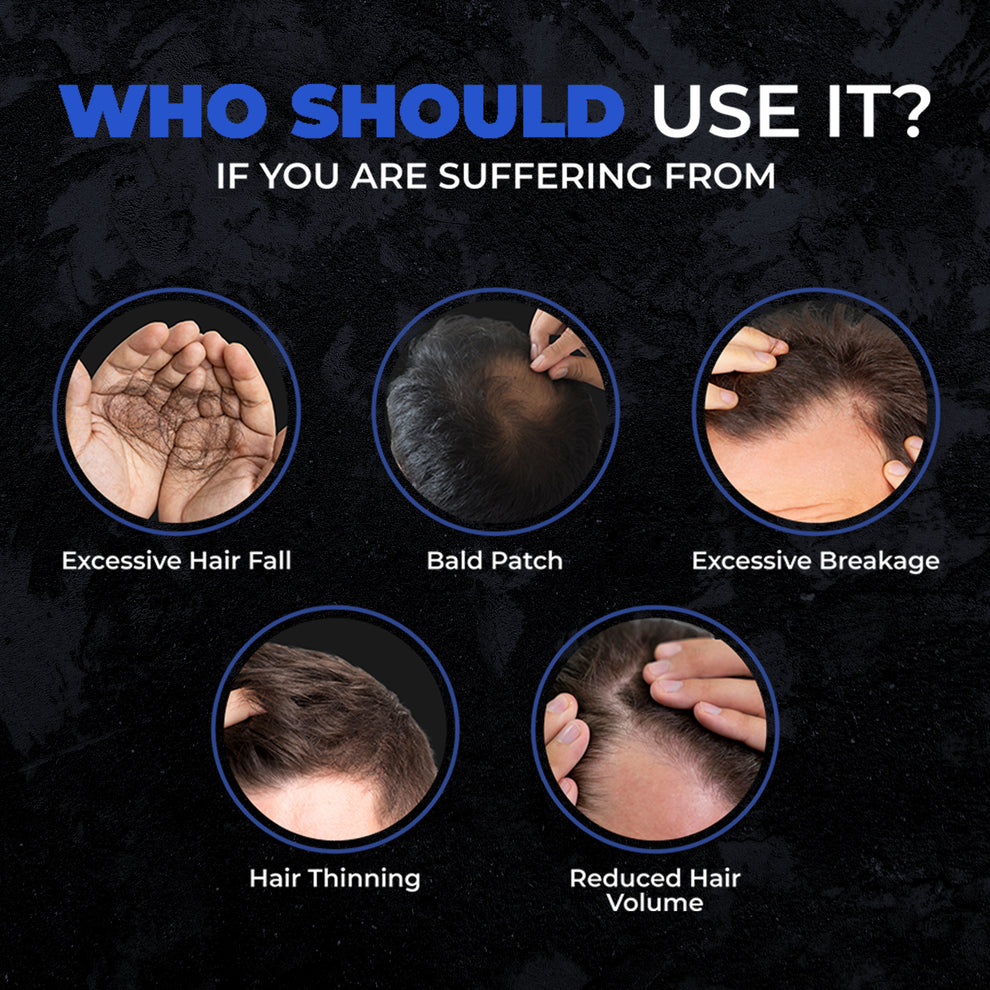 Beardo Hair Growth VitalizerN Beardo India