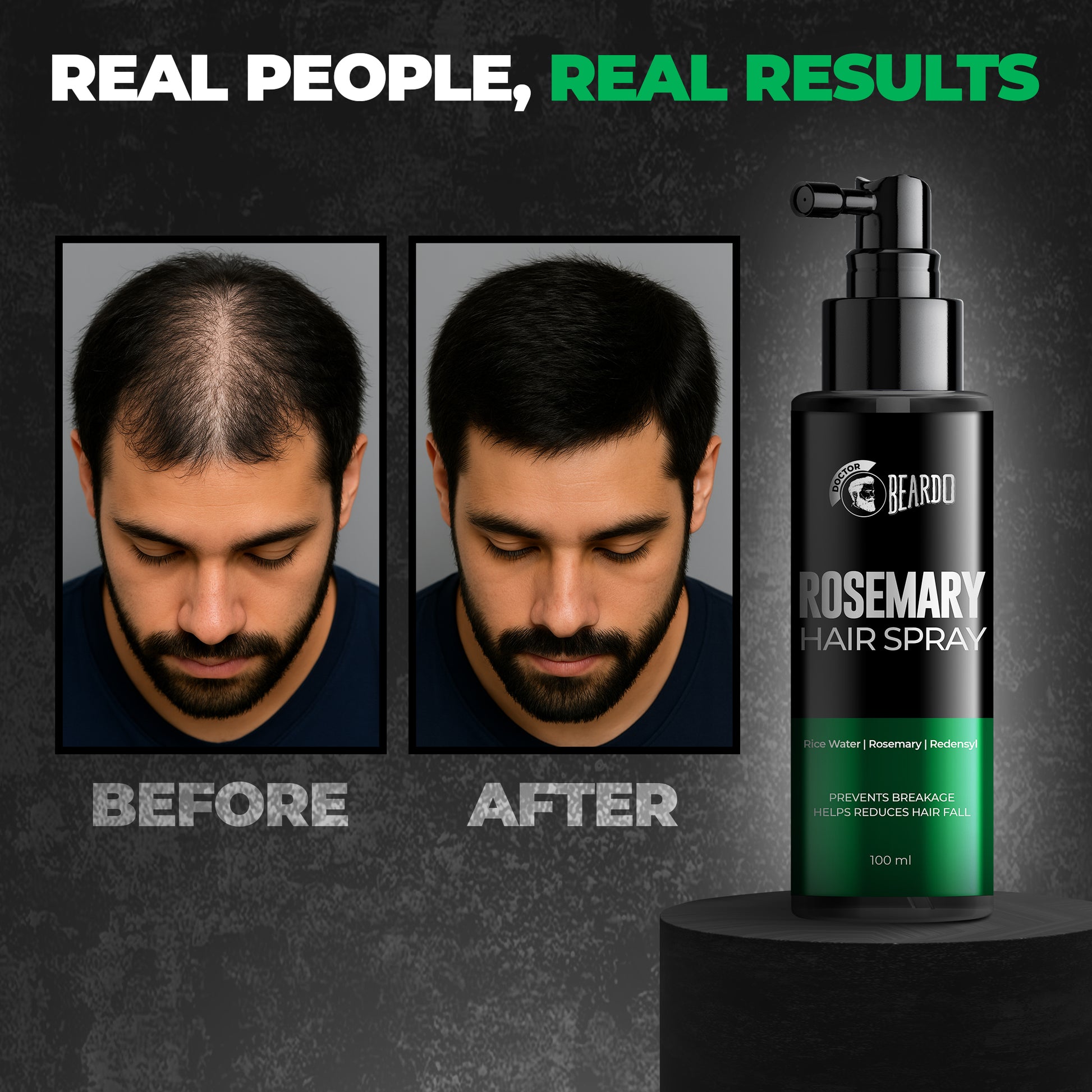 Beardo Rosemary Hair Spray (100ml)
