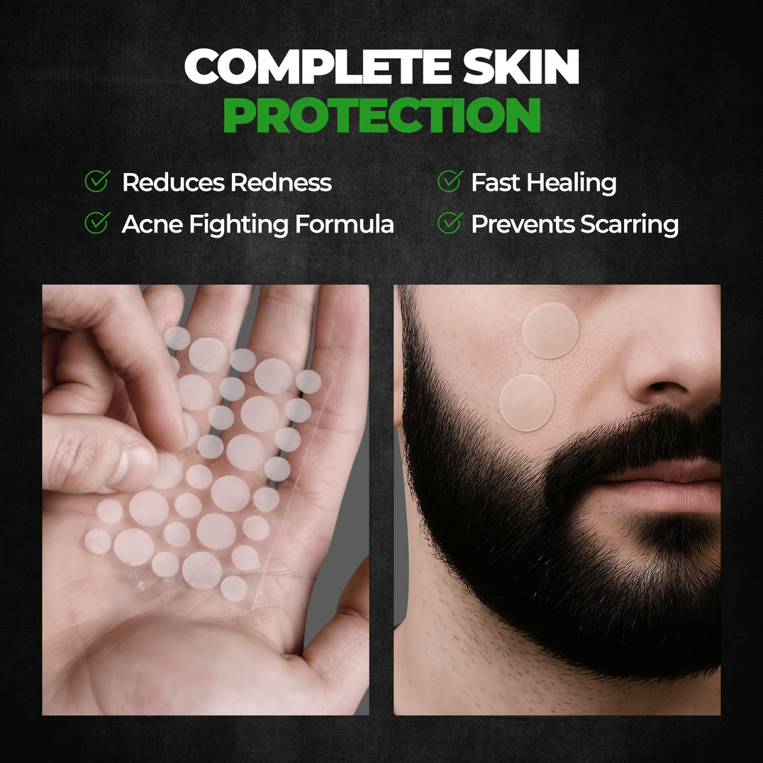 Beardo Doctor Acne Pimple Patch – grooming results and lifestyle