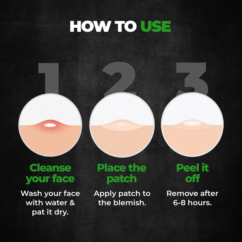 Doctor Acne Pimple Patch