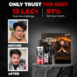 Beardo Don Beardo's Beard Growth Pro Kit – key ingredients and benefits