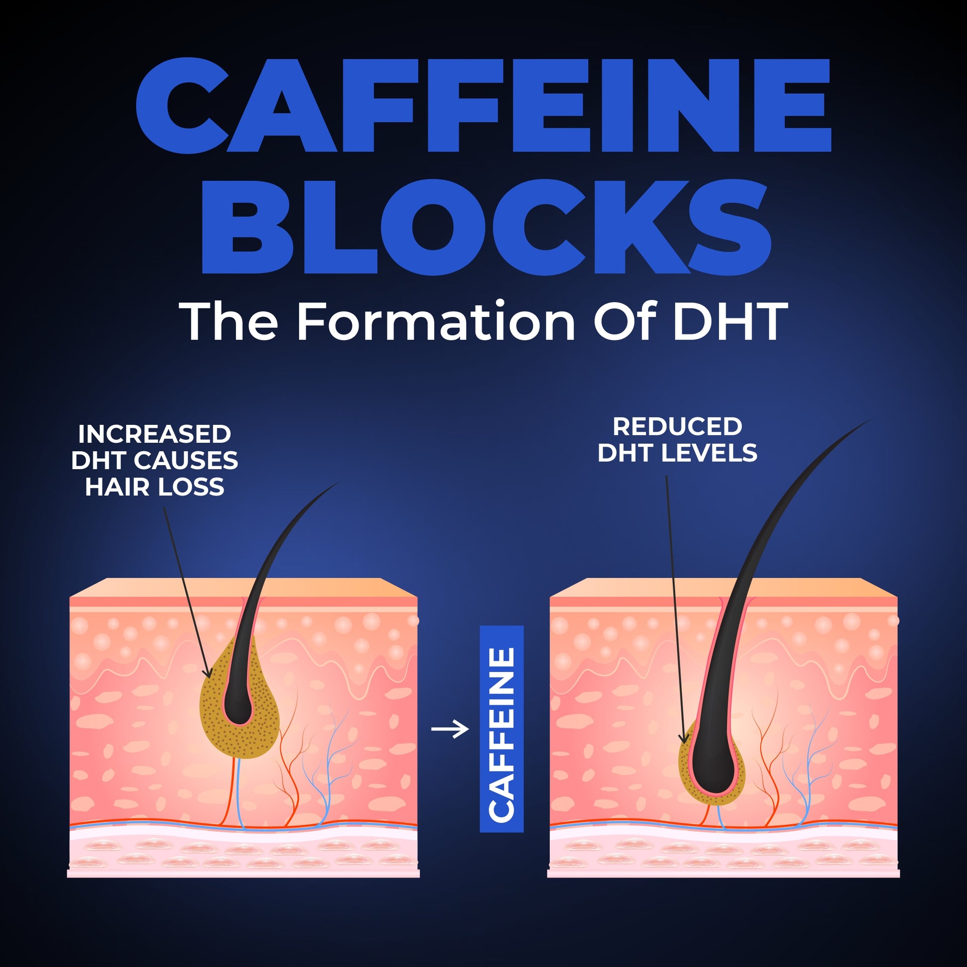 caffeine reduces dht levels