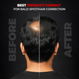 Beardo Hair Building Fiber