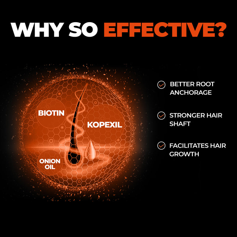 Hair Growth Sulphate Free Shampoo (100ml)