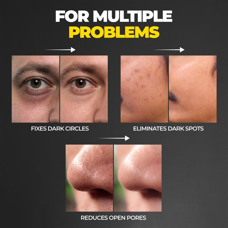 Beardo Ultra Glow Brightening Serum – key ingredients and benefits